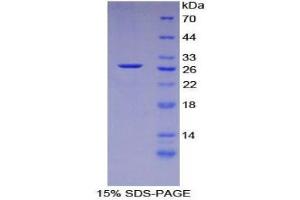 SDS-PAGE (SDS) image for Transforming Growth Factor, beta-Induced, 68kDa (TGFBI) (AA 423-632) protein (His tag) (ABIN1877740) (TGFBI Protein (AA 423-632) (His tag))