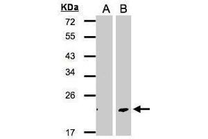 WB Image Western Blot analysis of DPT expression in transfected 293T cell line by DPT polyclonal antibody. (Dermatopontin antibody)