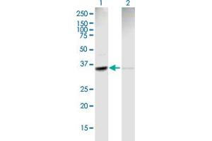Western Blot analysis of ACTR2 expression in transfected 293T cell line by ACTR2 MaxPab polyclonal antibody. (ACTR2 antibody  (AA 1-339))