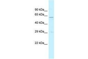 Image no. 1 for anti-Signal Recognition Particle 54kDa (SRP54) (AA 391-440) antibody (ABIN6747817) (SRP54 antibody  (AA 391-440))