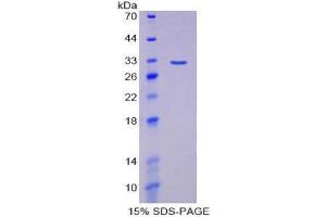 SDS-PAGE (SDS) image for Interferon Regulatory Factor 5 (IRF5) (AA 3-250) protein (His tag) (ABIN1980965)