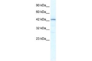 Western Blotting (WB) image for anti-SP140 Nuclear Body Protein-Like (SP140L) antibody (ABIN2461297) (SP140L antibody)