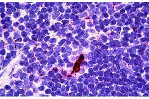 Human Lyphoid-Dendritic Cells: Formalin-Fixed, Paraffin-Embedded (FFPE) (EBI3 antibody)