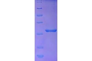 Embryonic Stem Cell Related (Non-Protein Coding) (ESRG) (AA 1-222), (full length) protein (His tag)