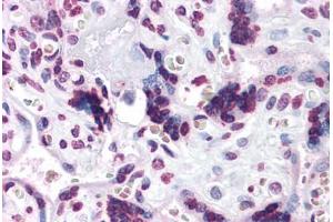 Human Placenta: Formalin-Fixed, Paraffin-Embedded (FFPE) (CARD14 antibody  (C-Term))