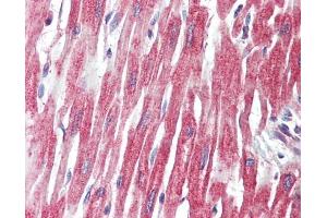 IHC-P Image PLCL1 antibody detects PLCL1 protein at cytoplasm on human placenta by immunohistochemical analysis.