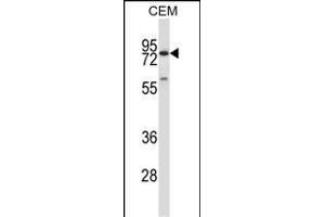 P16 Antibody (C-term) (ABIN657636 and ABIN2846632) western blot analysis in CEM cell line lysates (35 μg/lane). (MMP16 antibody  (C-Term))