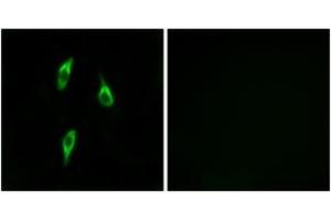 Immunofluorescence analysis of LOVO cells, using OR51B2 Antibody.