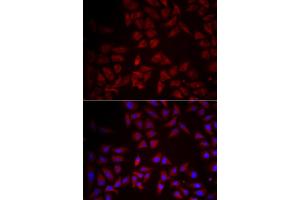 Immunofluorescence analysis of HeLa cells using CCL25 antibody. (CCL25 antibody)
