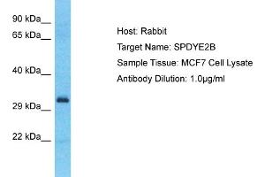 Host: Rabbit Target Name: SPDYE2B Sample Type: MCF7 Whole Cell lysates Antibody Dilution: 1. (SPDYE2B antibody  (C-Term))