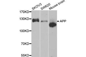 Western blot analysis of extracts of various cell lines, using APP antibody (ABIN5971616). (APP antibody)
