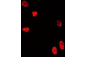 Immunofluorescent analysis of WDR5 staining in U2OS cells.