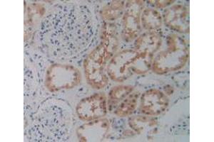 IHC-P analysis of Human Kidney Tissue, with DAB staining. (P2RX7 antibody  (AA 47-334))