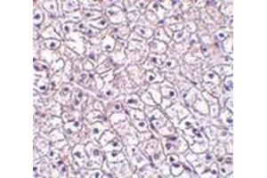 Immunohistochemistry of TSLP-R in human liver tissue with this product at 5 μg/ml. (CRLF2 antibody  (Center))