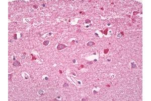 人类、大脑、皮层：福尔马林固定石蜡包埋（FFPE）。（RHOG抗体（AA 112-161））
