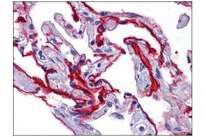 Human Lung: Formalin-Fixed, Paraffin-Embedded (FFPE) (SCUBE2 antibody)