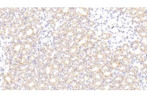 Detection of SNCa in Rat Kidney Tissue using Polyclonal Antibody to Synuclein Alpha (SNCa) (SNCA antibody  (AA 23-140))