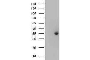 HEK293T cells were transfected with the pCMV6-ENTRY control (Left lane) or pCMV6-ENTRY ERCC1 (Right lane) cDNA for 48 hrs and lysed. (ERCC1 antibody)