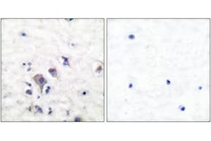 Immunohistochemistry analysis of paraffin-embedded human brain tissue, using mGluR2/3 Antibody. (mGluR2/3 antibody  (AA 823-872))