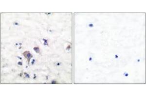 Immunohistochemistry analysis of paraffin-embedded human brain tissue, using mGluR2/3 Antibody.