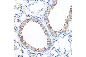 Immunohistochemistry (IHC) image for anti-Anterior Gradient Homolog 2 (Xenopus Laevis) (AGR2) (AA 21-175) antibody (ABIN6136646)