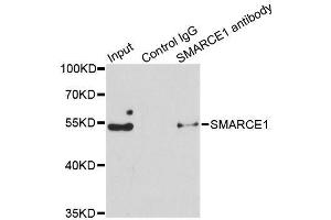 Immunoprecipitation analysis of 150ug extracts of Jurkat cells using 3ug SMARCE1 antibody. (SMARCE1 antibody  (AA 1-411))