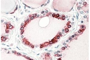 AP31571PU-N (5µg/ml) staining of paraffin embedded Human Thyroid Gland. (Thyroperoxidase antibody  (C-Term))