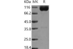 Interleukin 18 Receptor 1 (IL18R1) protein (Fc Tag)
