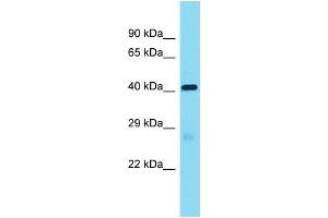 Host:  Rabbit  Target Name:  Lrrc19  Sample Type:  Mouse Heart lysates  Antibody Dilution:  1. (LRRC19 antibody  (Middle Region))
