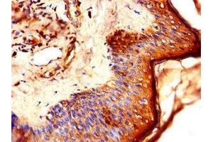 Immunohistochemistry of paraffin-embedded human skin tissue using ABIN7157921 at dilution of 1:100 (LCE1B antibody  (AA 1-118))