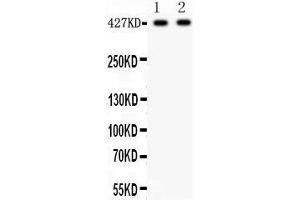 Anti- Dystrophin Picoband antibody, Western blotting All lanes: Anti Dystrophin  at 0. (Dystrophin antibody  (AA 3076-3404))