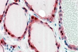 ABIN302136 (2. (FZD2 antibody  (Internal Region))