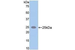 Detection of Recombinant SPTAN1, Rat using Polyclonal Antibody to Alpha-Fodrin (SPTAN1) (SPTAN1 antibody  (AA 2071-2269))
