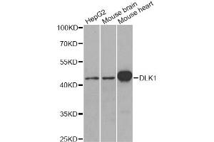 Western blot analysis of extracts of various cell lines, using DLK1 antibody.