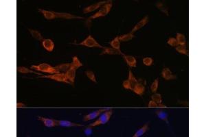Immunofluorescence analysis of NIH-3T3 cells using YWHAH Polyclonal Antibody at dilution of 1:100 (40x lens). (14-3-3 eta antibody)