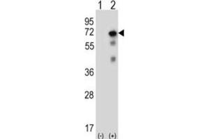 Western Blotting (WB) image for anti-Ubiquitin Specific Peptidase 2 (USP2) antibody (ABIN3001466) (USP2 antibody)