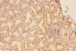Anti-CXCR3 Picoband antibody,  IHC(P): Rat Kidney Tissue
