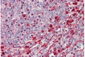 Human Spleen: Formalin-Fixed, Paraffin-Embedded (FFPE) (MEK1 + MEK2 antibody  (AA 189-238))