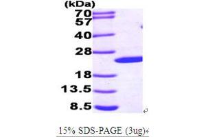 SDS-PAGE (SDS) image for Sonic Hedgehog (SHH) (AA 24-197) protein (His tag) (ABIN667009)