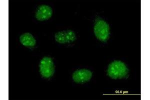 Immunofluorescence of purified MaxPab antibody to RBM41 on HeLa cell. (RBM41 antibody  (AA 1-413))