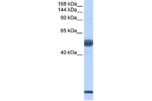 SF3B14 antibody used at 2 ug/ml to detect target protein.