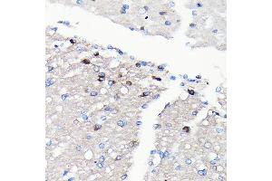 Immunohistochemistry of paraffin-embedded rat brain using NMDA Rabbit mAb (ABIN7267420) at dilution of 1:100 (40x lens). (NMDAR2A antibody)