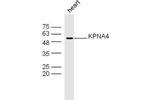 Mouse heart lysates probed with KPNA4 Polyclonal Antibody, Unconjugated  at 1:300 dilution and 4˚C overnight incubation.