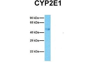 Host:  Rabbit  Target Name:  CYP2E1  Sample Tissue:  Human Fetal Lung  Antibody Dilution:  1. (CYP2E1 antibody  (C-Term))