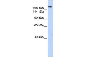 WB Suggested Anti-DYSF Antibody Titration:  0.
