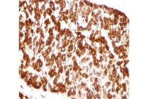 Immunohistochemistry (IHC) image for anti-Desmin (DES) (AA 332-359) antibody (ABIN3030719)