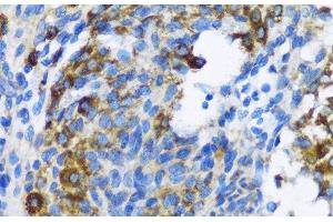 Immunohistochemistry of paraffin-embedded Rat ovary using PTCH1 Polyclonal Antibody at dilution of 1:100 (40x lens). (Patched 1 antibody)