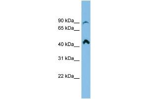 WB Suggested Anti-RP11-298P3. (RP11-298P3.3 (N-Term) antibody)