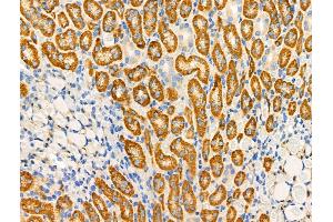 ABIN6259707 and ABIN6276744 at 1/100 staining Rat kidney tissue by IHC-P.