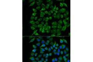 Immunofluorescence analysis of U2OS cells using PAEP Polyclonal Antibody (PAEP antibody)